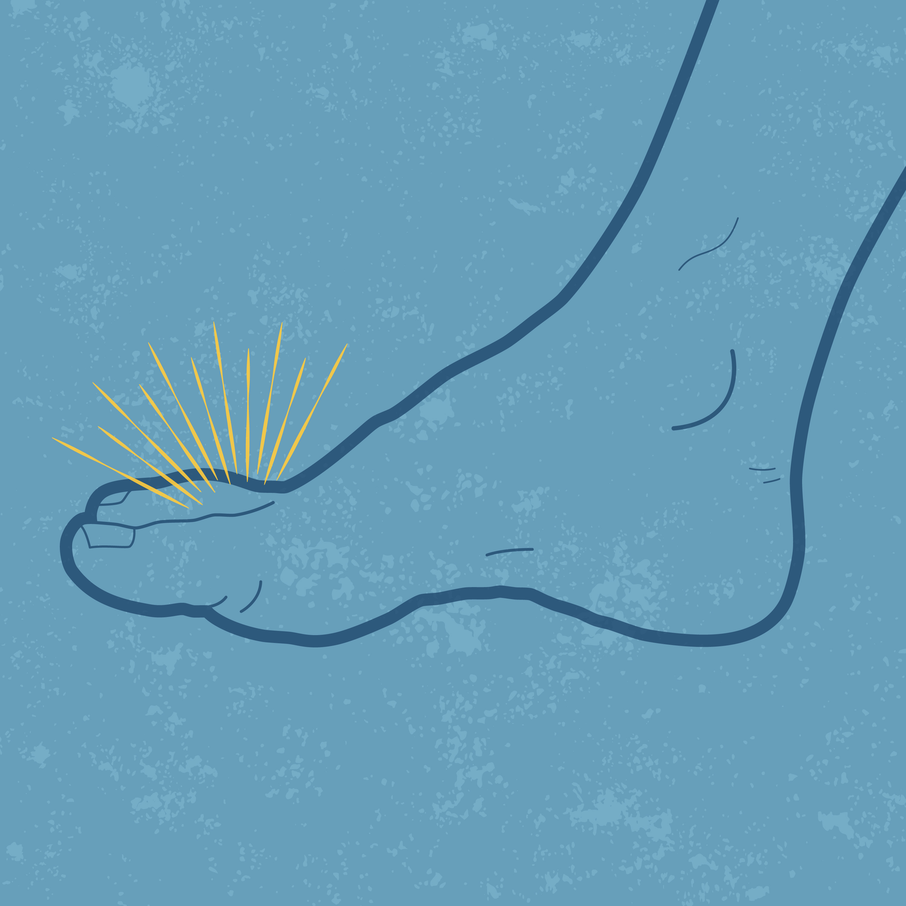 Graphic to depict gout on someone's foot
