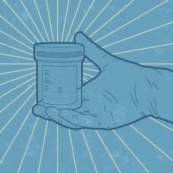 Graphic of a hand holding a cup of urine
