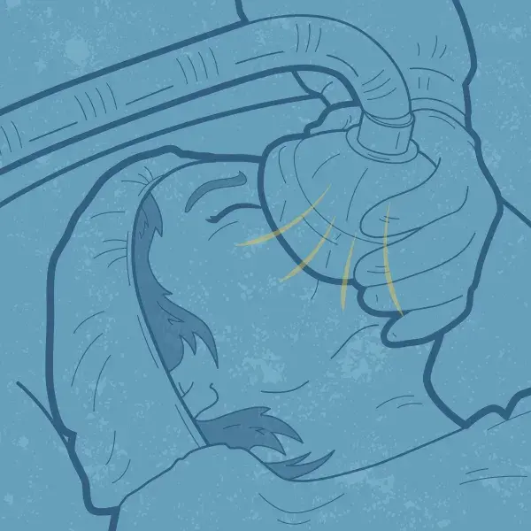Graphic showing someone going under anesthesia