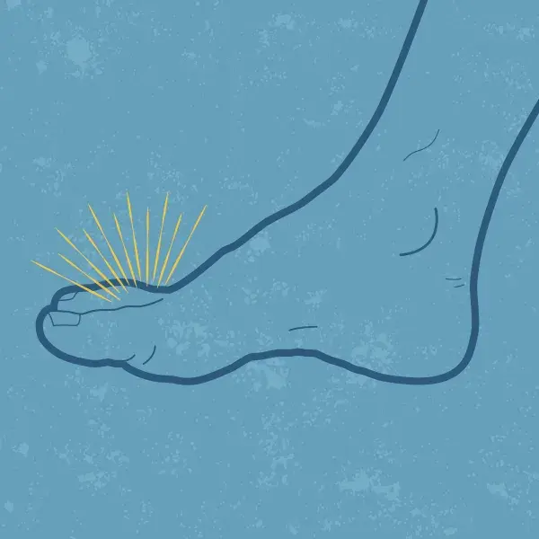 Graphic to depict gout on someone's foot