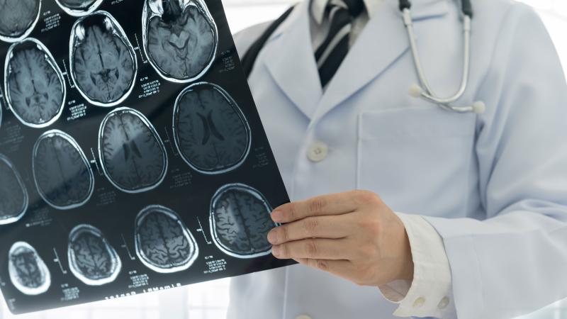 A doctor looking over a MRI scan of a brain