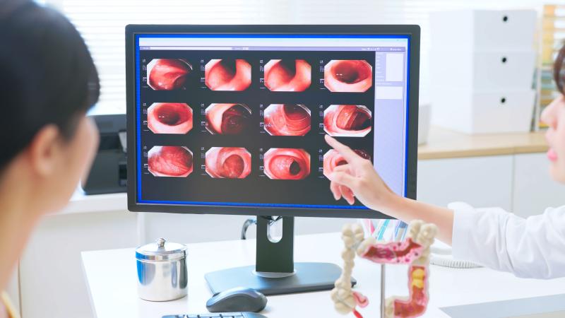 Doctor and patient looking at colonoscopy results