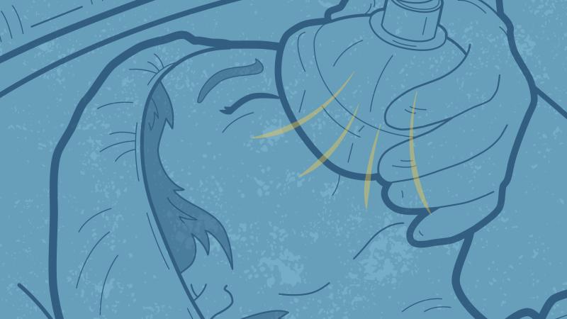 Graphic showing someone going under anesthesia