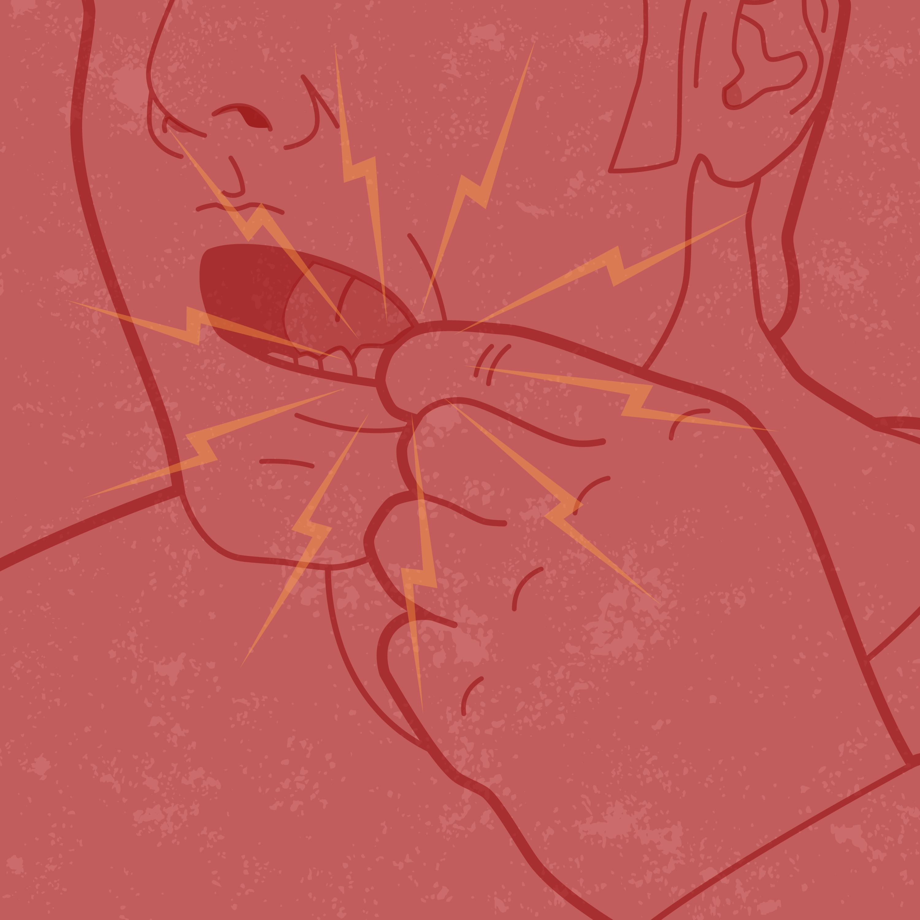 Canker sores