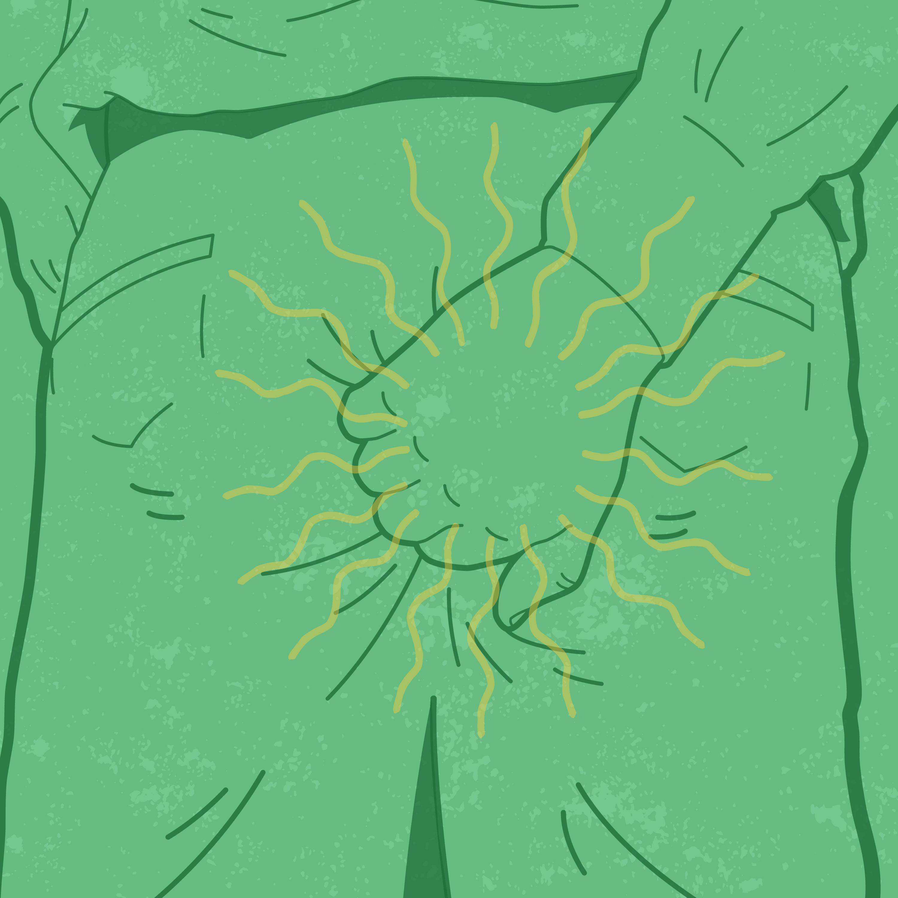 Anal itching