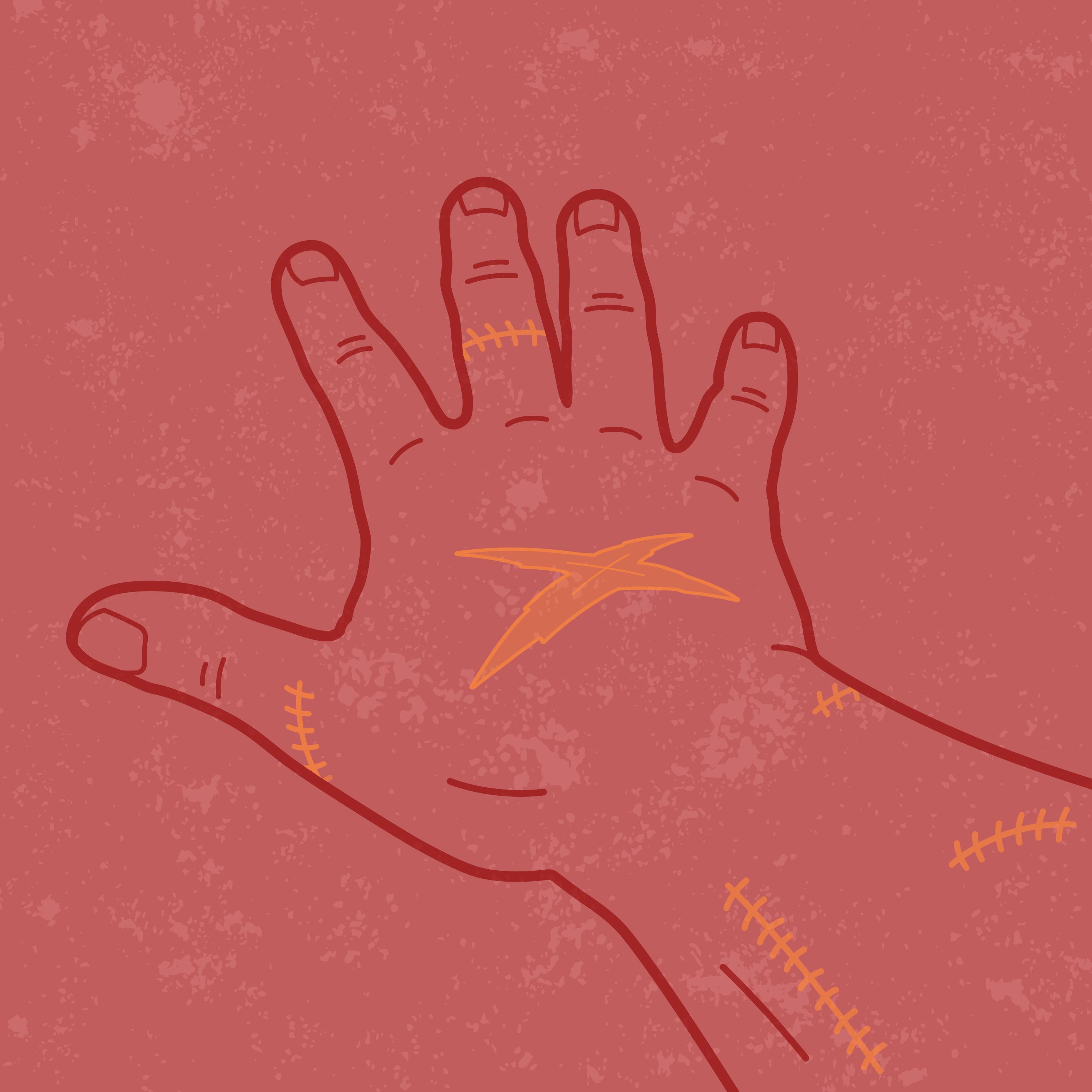 Graphic showing hand and wrist with scabs and scars