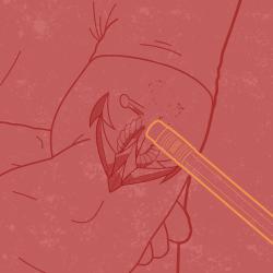 Tattoo removal graphic