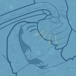 Graphic showing someone going under anesthesia