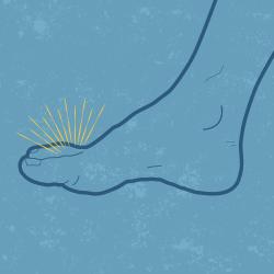 Graphic to depict gout on someone's foot